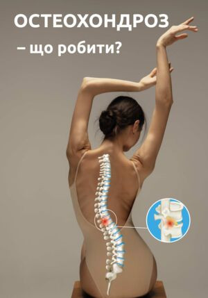 Остеохондроз – что делать?