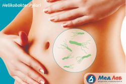 Заражение Helicobacter pylori: симптомы, последствия, лечение