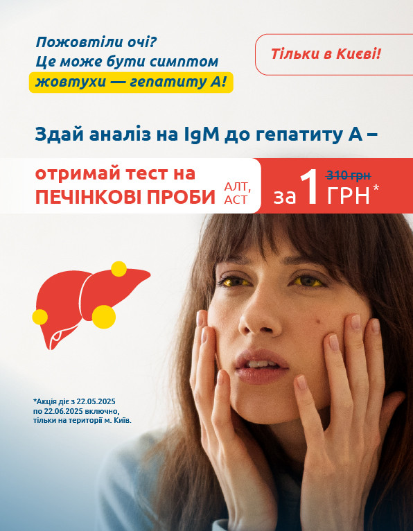 При здачі аналізу крові на IgM до вірусу гепатиту А — ви отримуєте печінкові проби АЛТ та АСТ всього за 1 гривню!