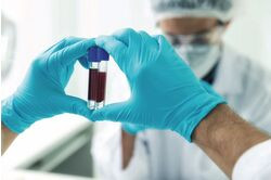 Коронавирус и биомаркеры. Зачем нужны анализы на D-димер, С-реактивный белок и ферритин