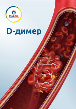 D-димер – один з найважливіших факторів зсідання крові.